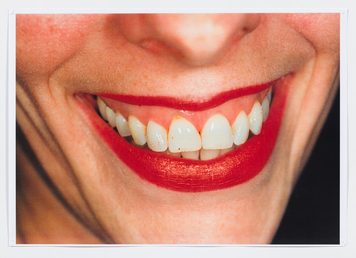 Common Sense [Teeth]